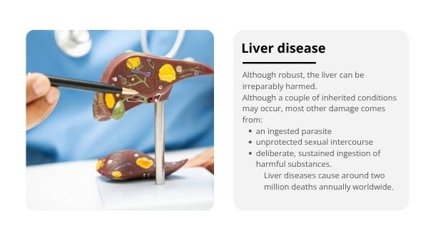 The Liver and Preventable Disease Education Presentation — slide 10