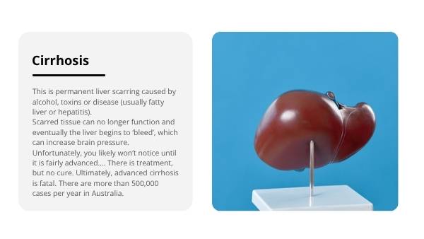 The Liver and Preventable Disease Education Presentation — slide 12